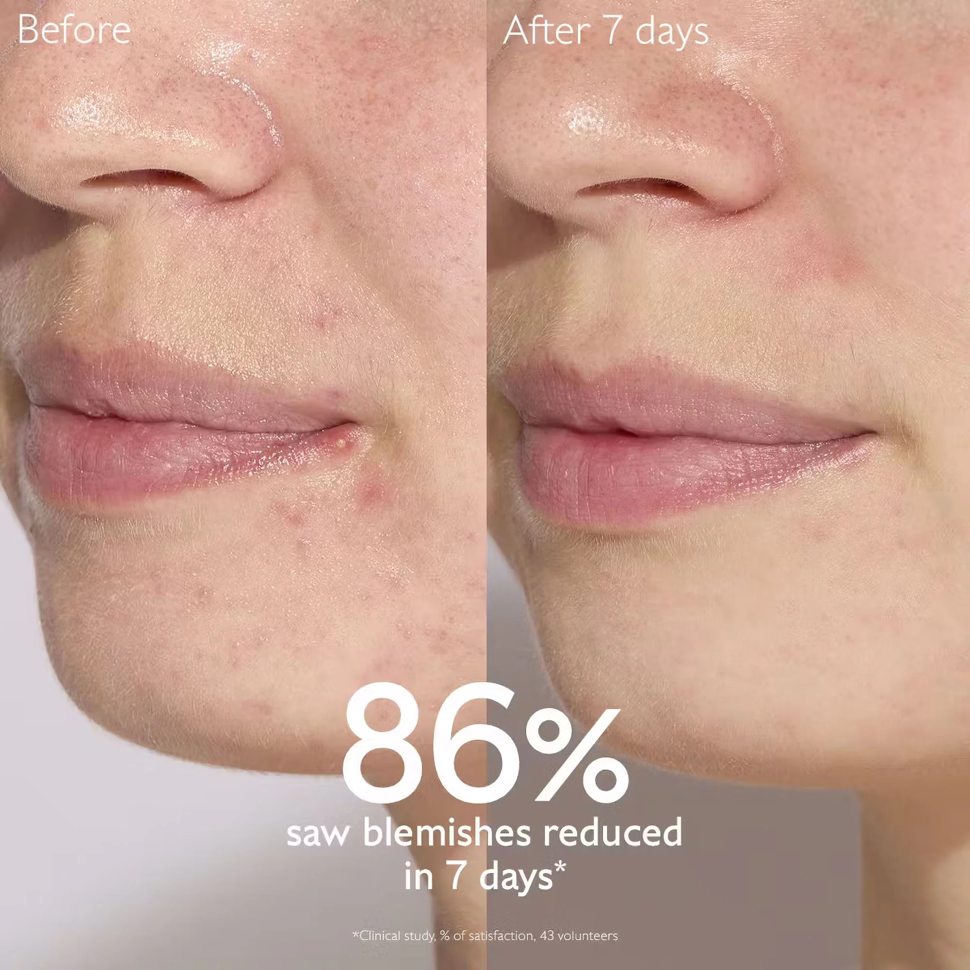 CAUDALIE Vinopure Blemish Control Salicylic Serum - Image 4