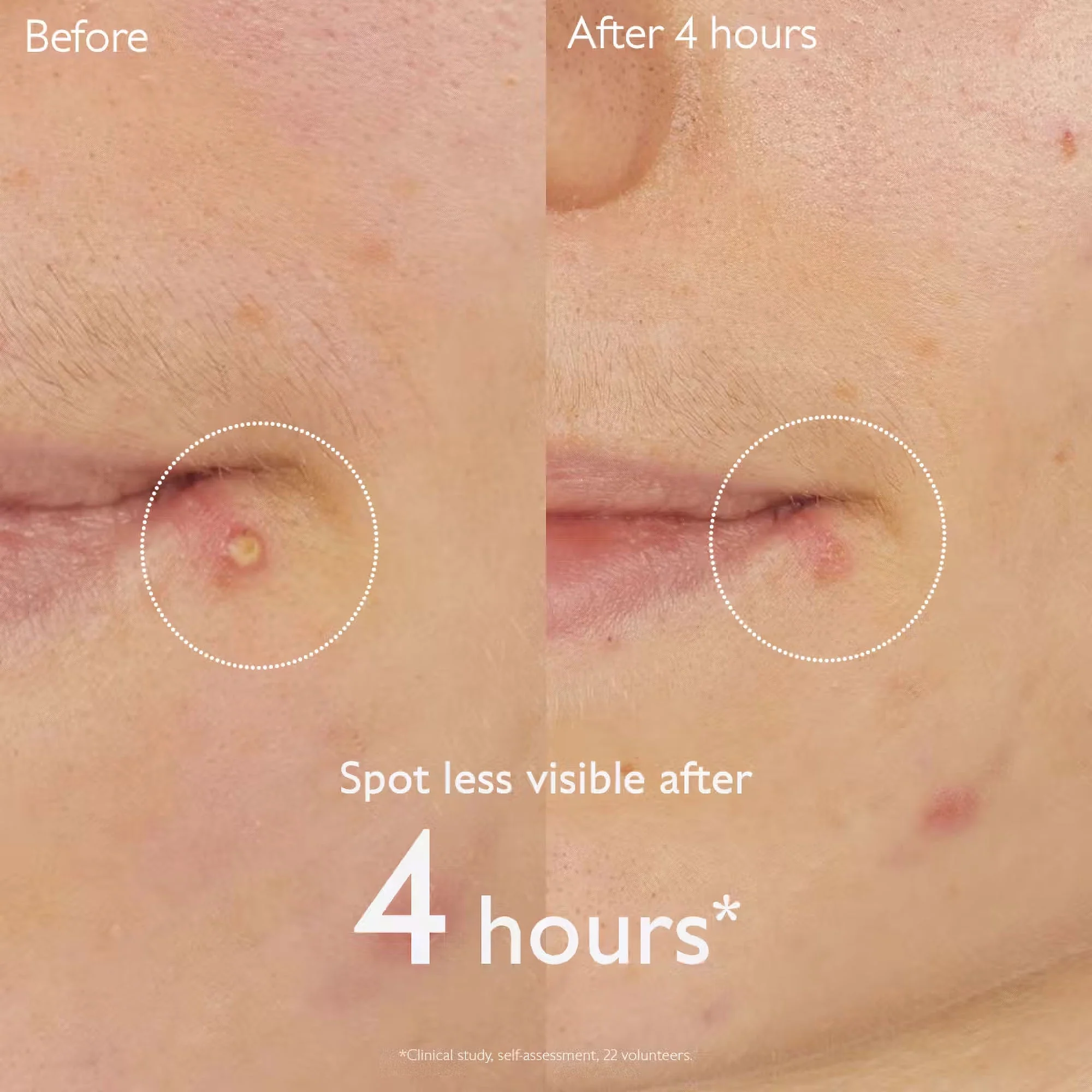 CAUDALIE Vinopure Salicylic Spot Solution - Image 3