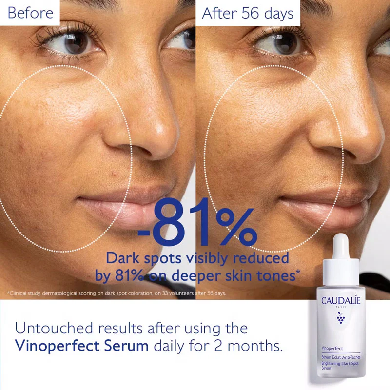 CAUDALIE Vinoperfect Brightening Dark Spot Serum & FREE Suncare Set - Image 7